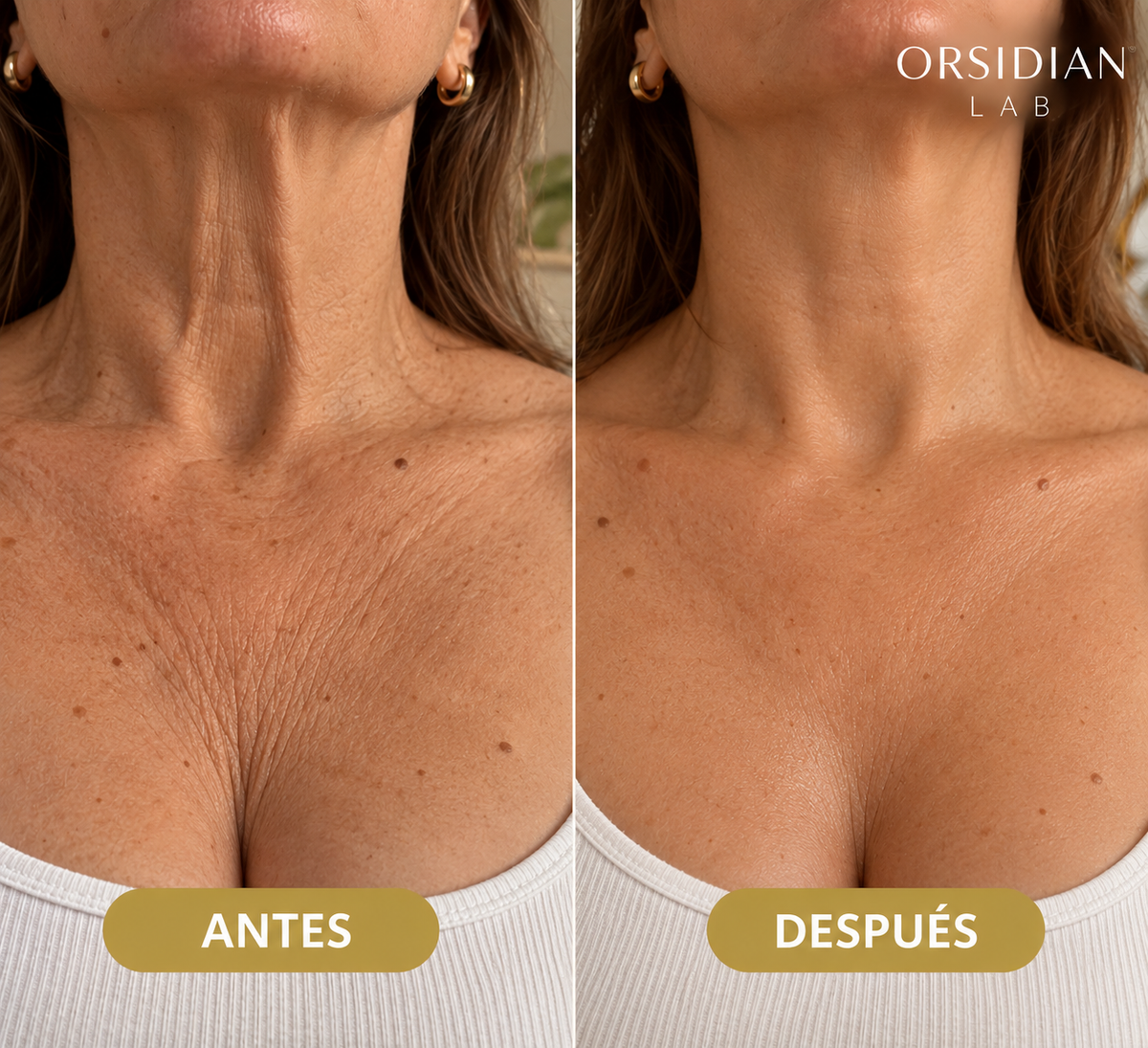 Élixir® - Aceite corporal reafirmante